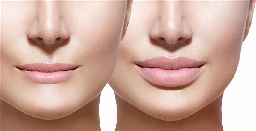 lips_before_and_after